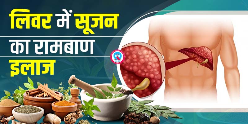 लिवर-में-सूजन-का-रामबाण-इलाज